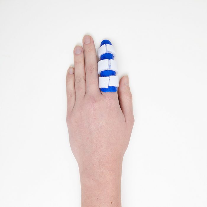 Finger Dislocation Melbourne Hand Rehab Hand Therapy