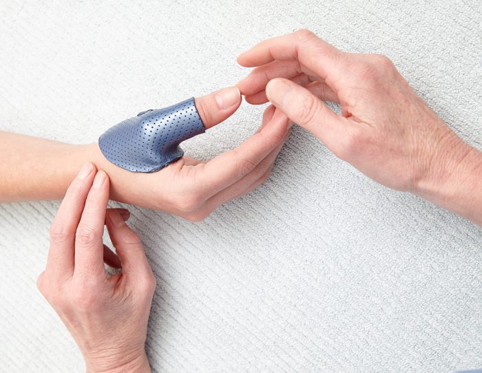 Thumb Arthritis Melbourne Hand Hand Therapy
