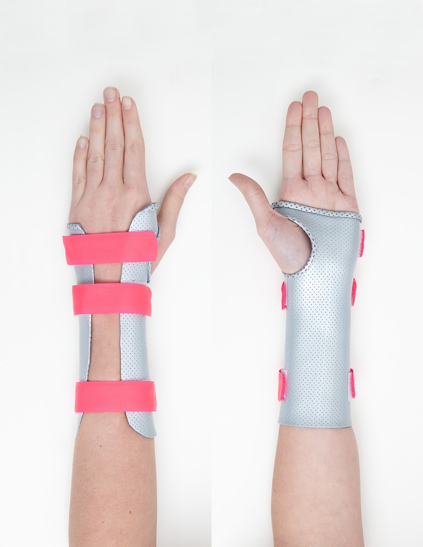 carpal-tunnel-syndrome-symptoms-treatment