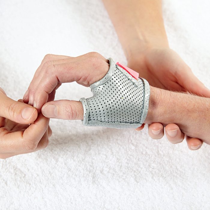Splints and Braces Melbourne Hand Rehab Hand Therapy Specialists