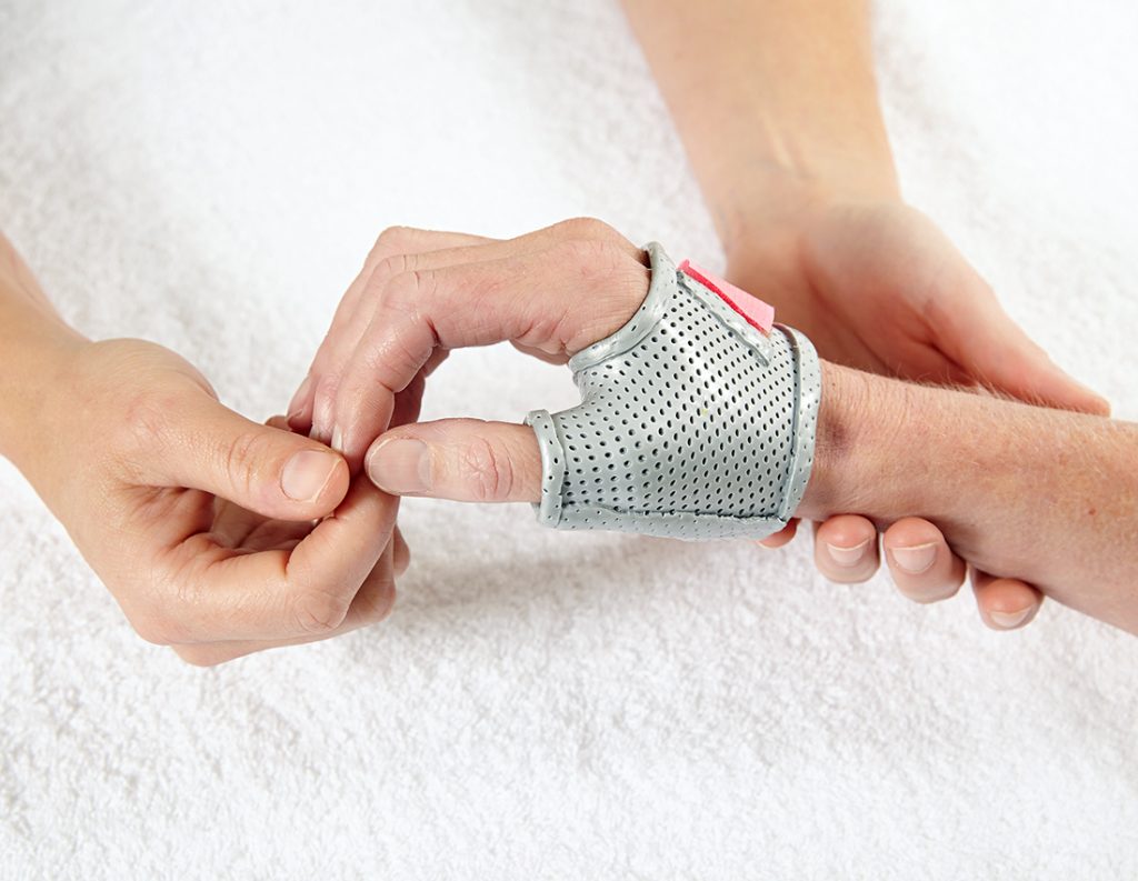 Melbourne Hand Therapy, Arthritis