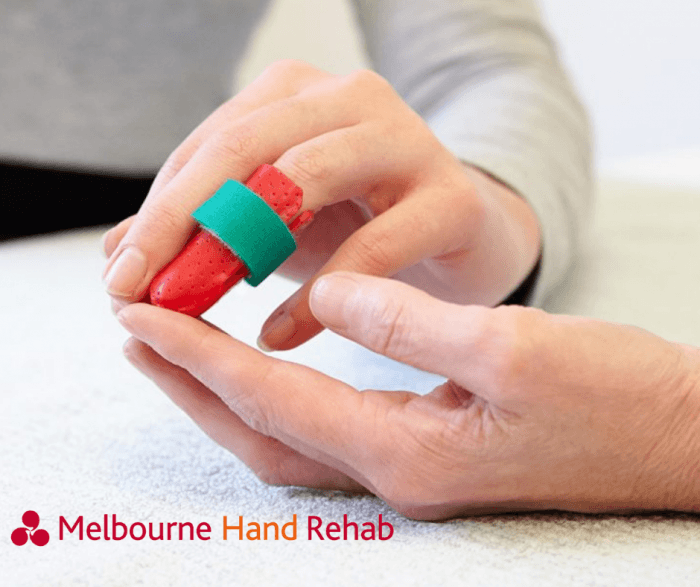 Mallet Finger Why won't my fingertip straighten? Melbourne Hand