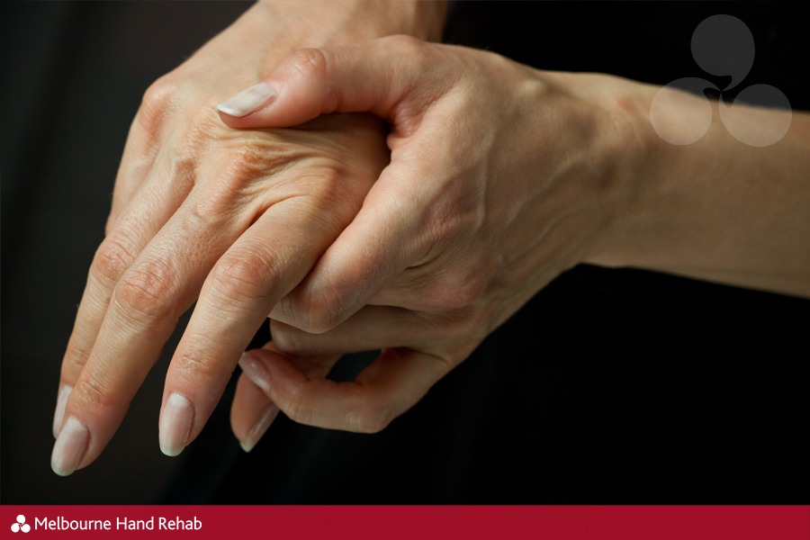 Female hands soothing their painful joints.