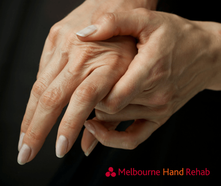 Is there NOTHING I can do about my crooked painful hands? Melbourne Hand