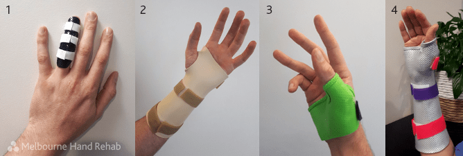 Image showing the four most common splints at Melbourne Hand Rehab: finger splint, wrist immobilisation splint, thumb spica, and the wrist and thumb immobilisation splint 