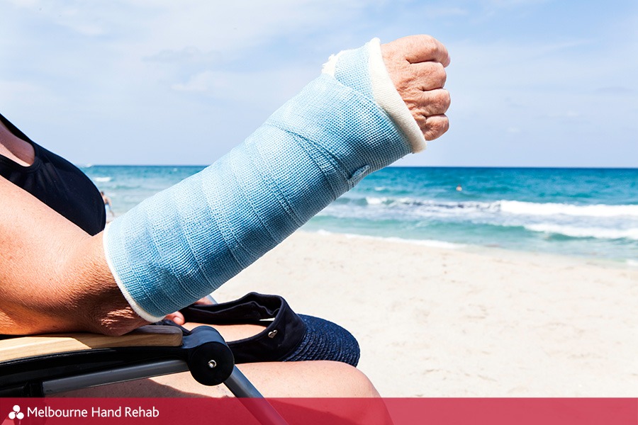 Woman enjoying the beach with a waterproof cast.