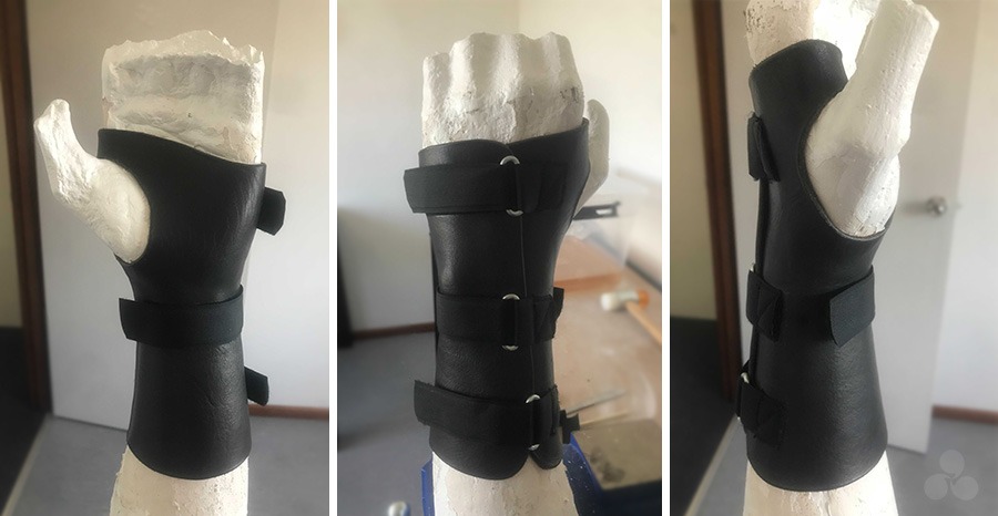 A custom made leather splint by Melbourne Hand Rehab 