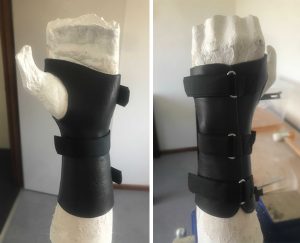A custom made leather brace by Melbourne Hand Rehab