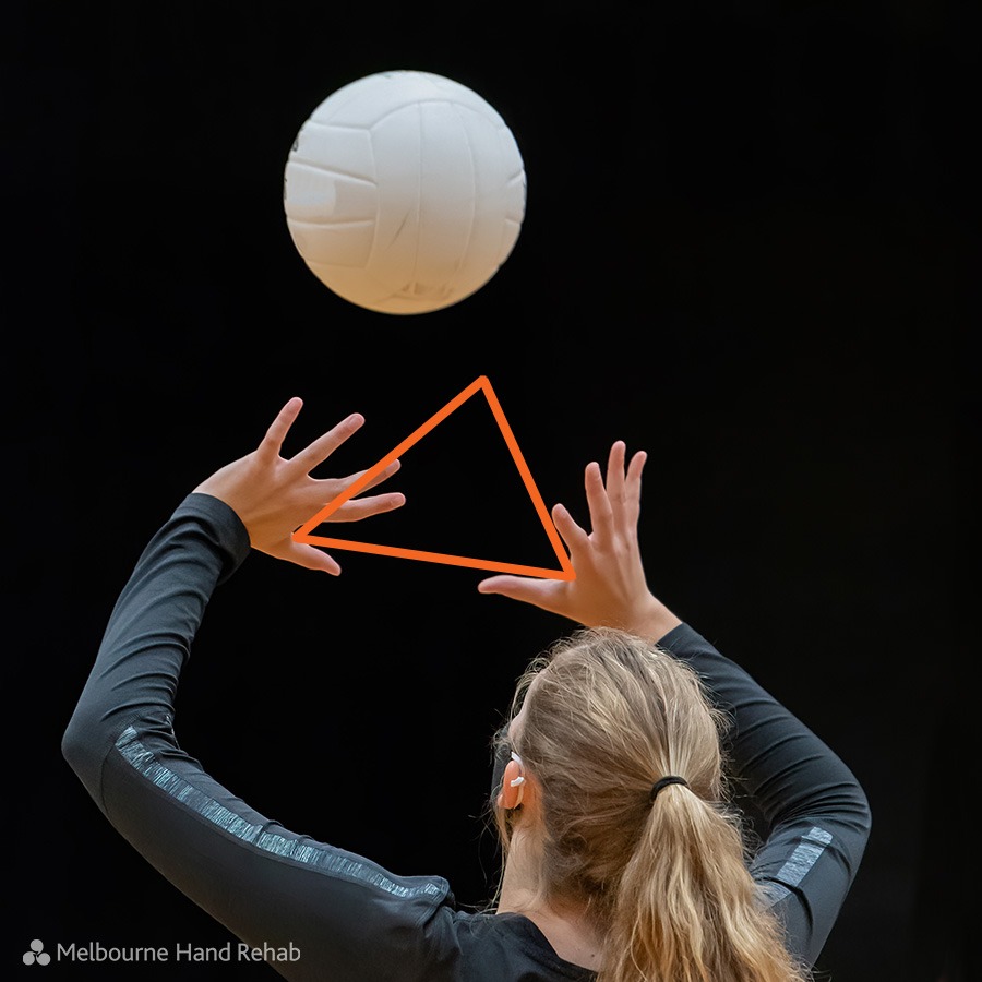 common-upper-limb-volleyball-injuries-melbourne-hand-rehab