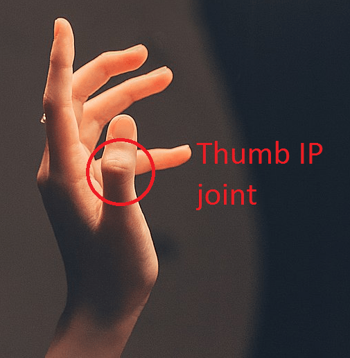 Fantastic thumb instabilities and where to find them Melbourne Hand