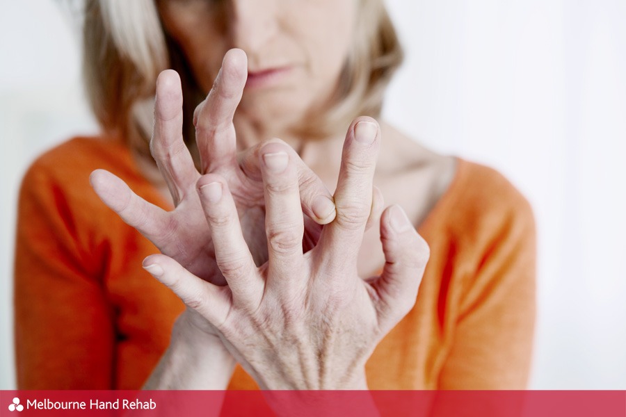 What’s the difference between rheumatoid arthritis and osteoarthritis?