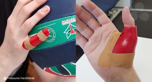 Melbourne Hand rehab custom make splints and braces for sports injuries