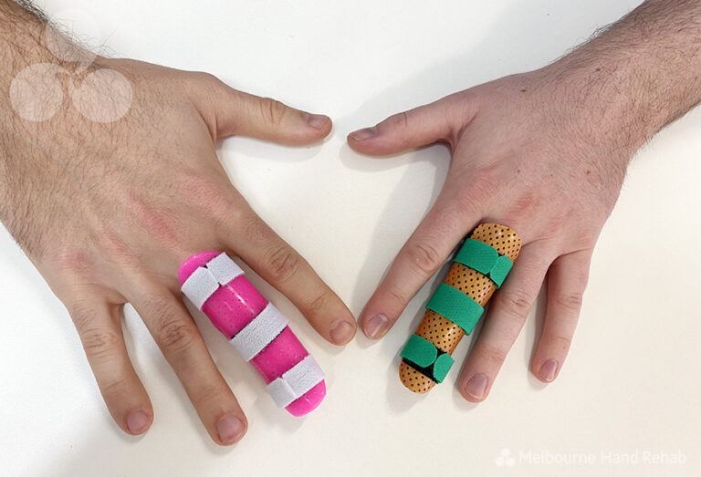 Common basketball finger injuries Melbourne Hand Rehab