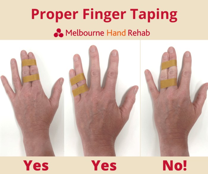 Common basketball finger injuries Melbourne Hand Rehab
