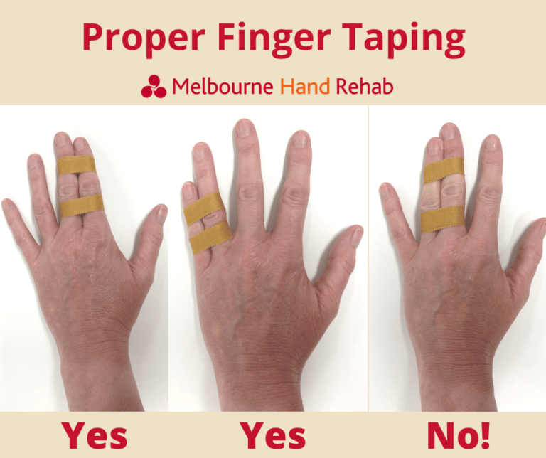 Common basketball finger injuries Melbourne Hand Rehab