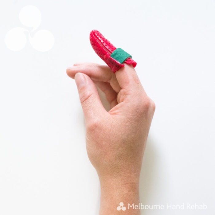 Common basketball finger injuries Melbourne Hand Rehab