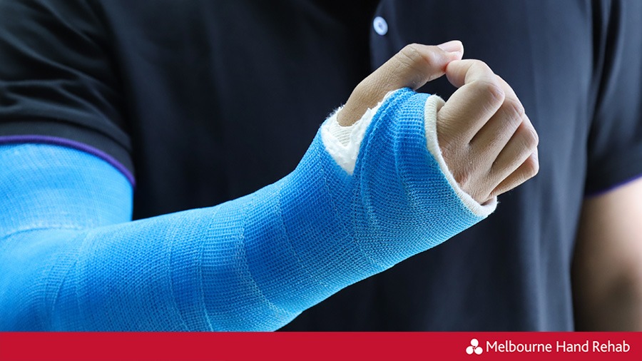 Hand Fracture Plaster