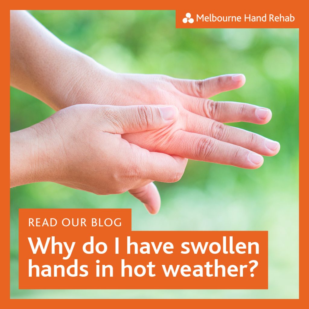 Graphic for: Read our blog – Why do I have swollen hands in hot weather?