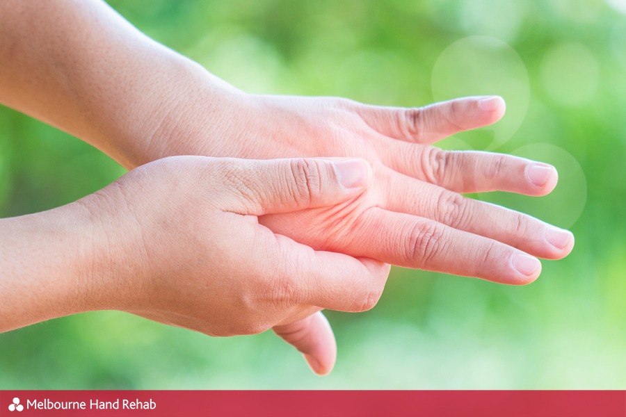 Close up of swollen hands caused by hot weather.