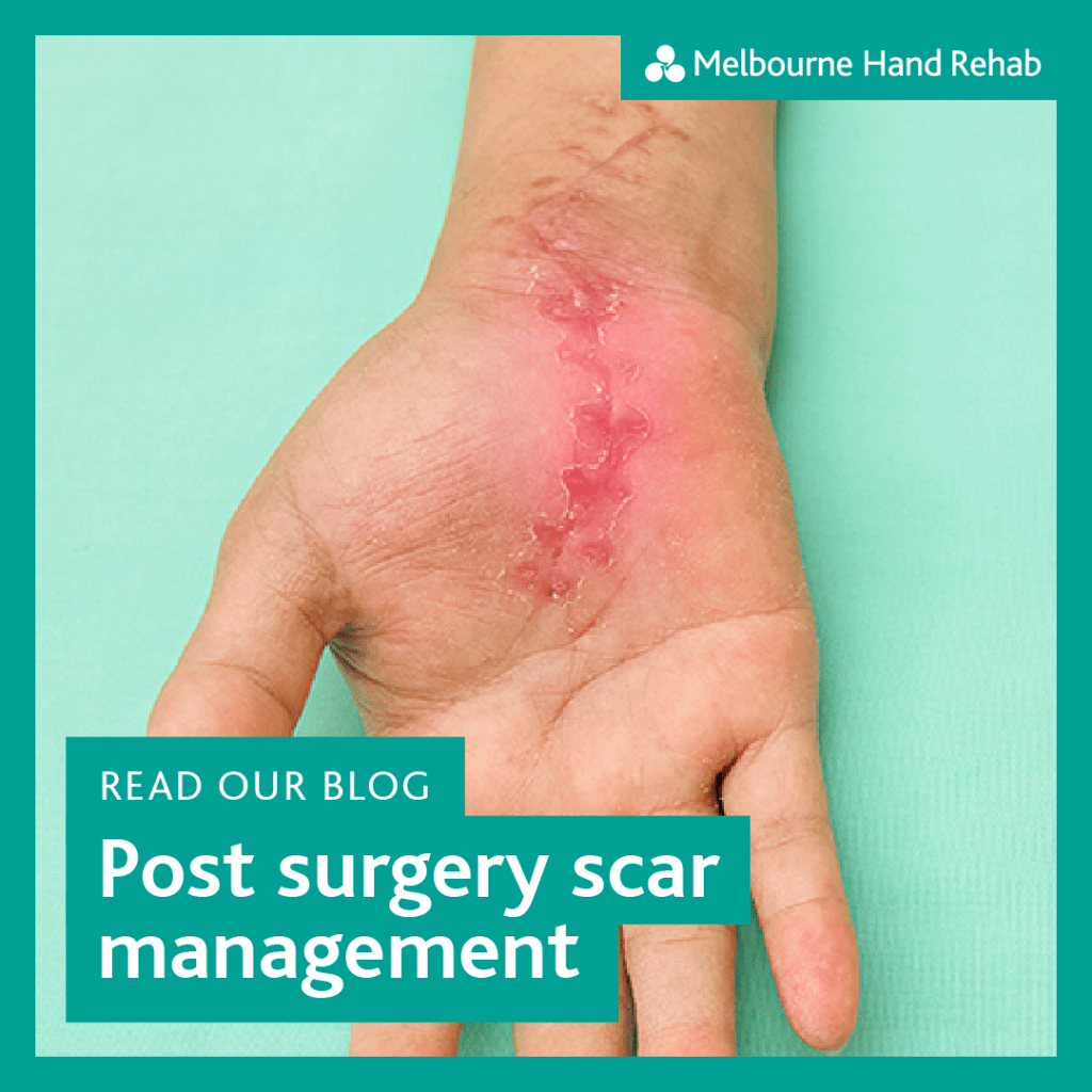 Read our blog: Post surgery scar management.
