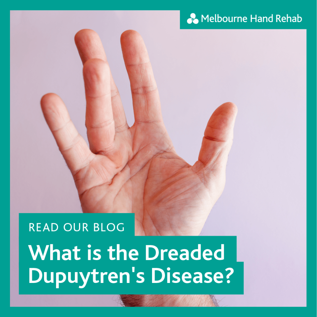 Read our blog: What is the Dreaded Dupuytren's Disease?