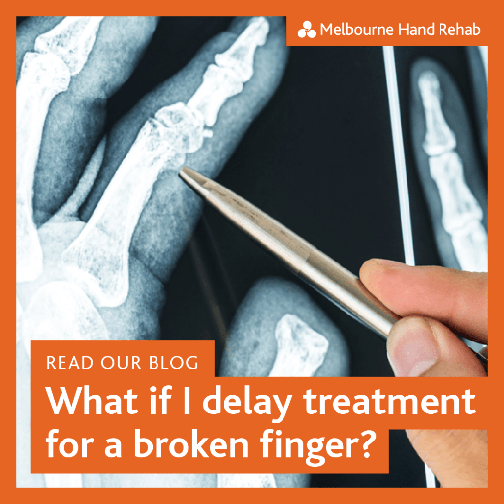 Read our blog: What happens if you delay treatment for a broken finger?
