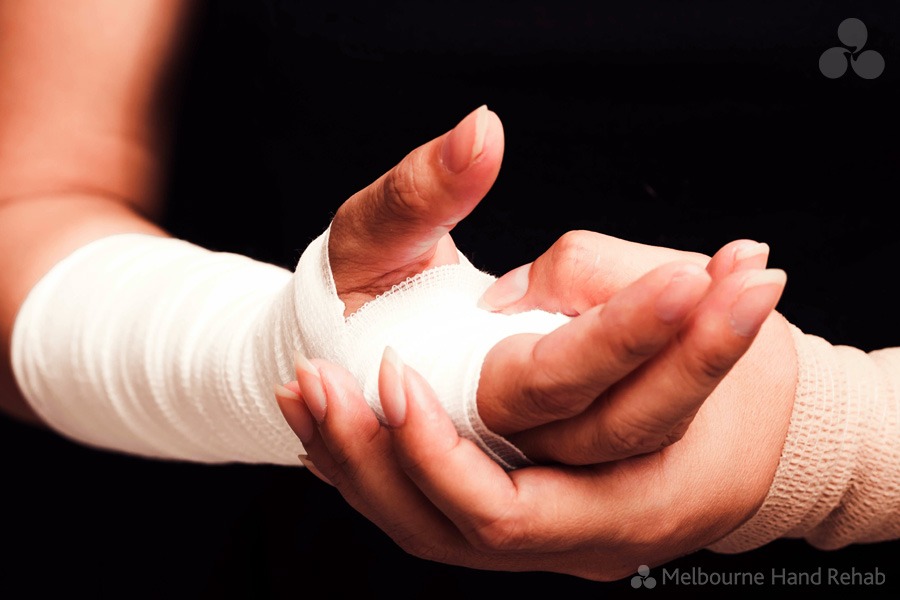What is a boxer’s fracture? Melbourne Hand Rehab