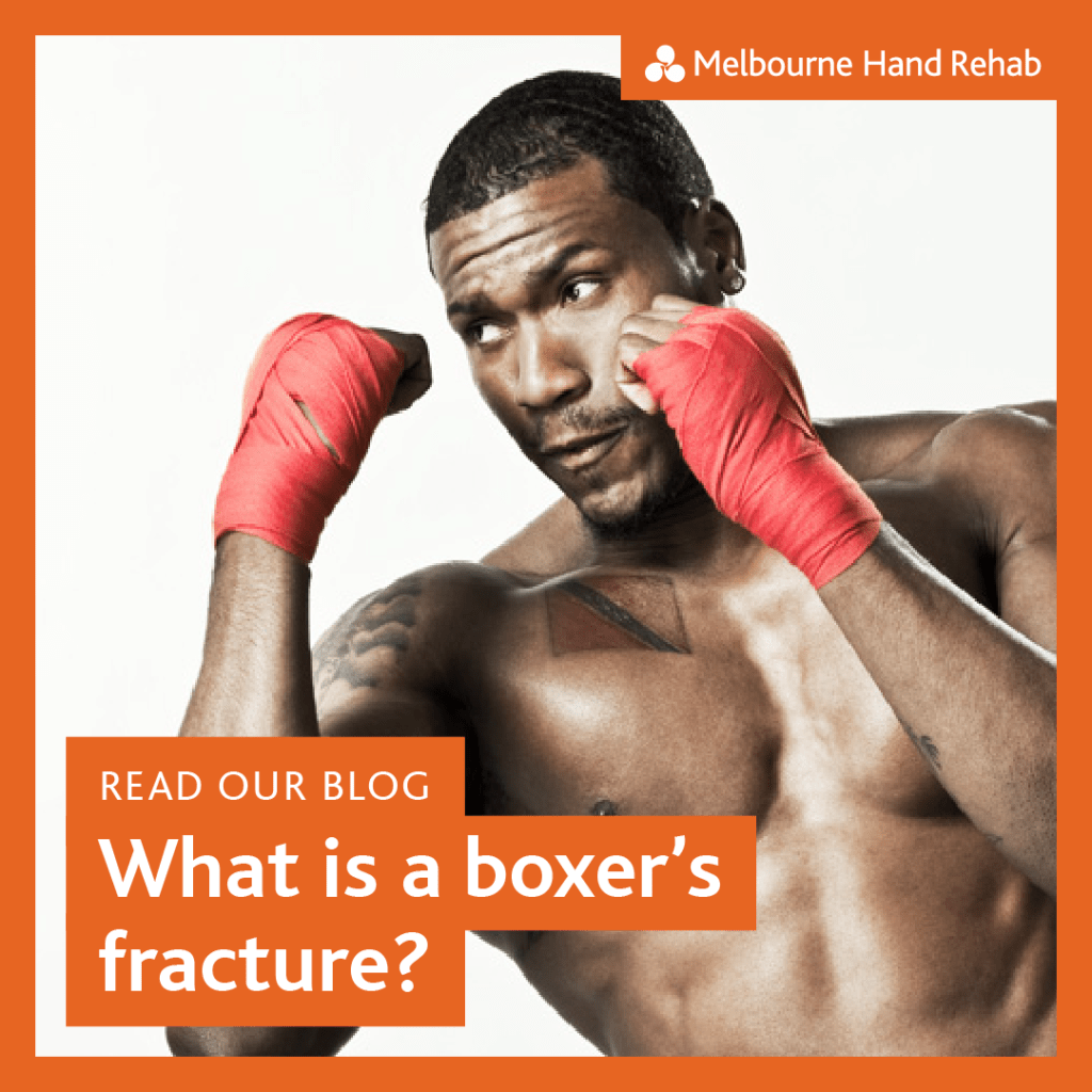 Graphic for, Read Our Blog: What is a boxer's fracture?