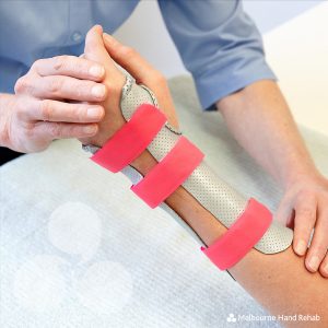 Melbourne Hand Rehab – custom made and waterproof splints and hand braces