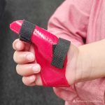 Melbourne Hand Rehab Red splint for Paediatric Trigger Thumb