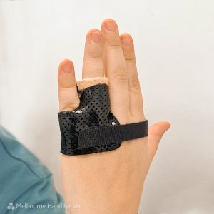 Melbourne Hand Rehab Splint for Trigger Finger