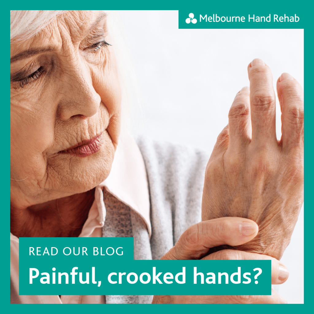 Read our blog: Is there anything you can do about painful, crooked hands?