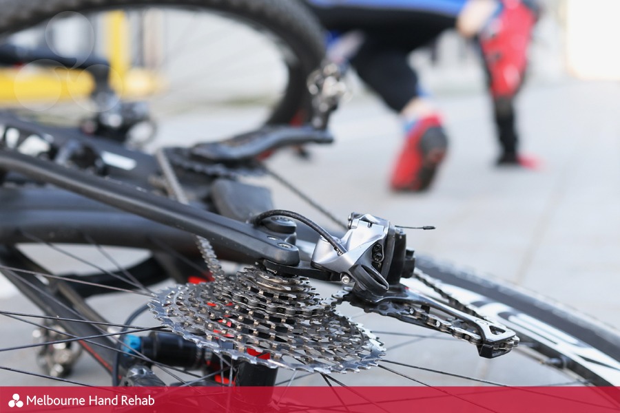 Read our blog: Cyclists in good hands, returning to cycling after a hand injury.