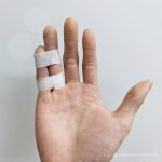 Example of buddy taping. Suitable for finger injuries such as fractures and ligament injuries