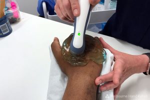 Therapeutic ultrasound for scar management hand therapy